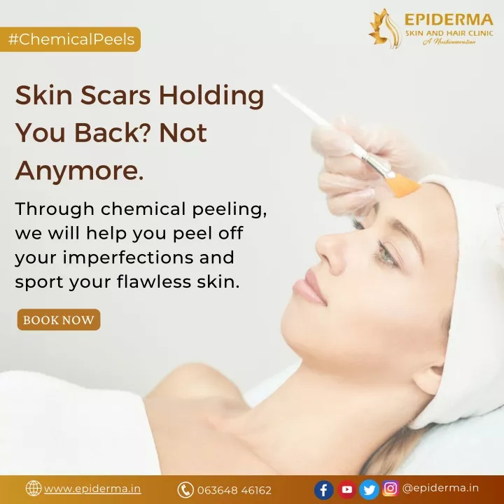 Ppt Is Skin Scars Holding You Back Dermatologist In Jayanagar