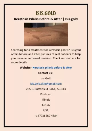 keratosis pilaris before after isis gold