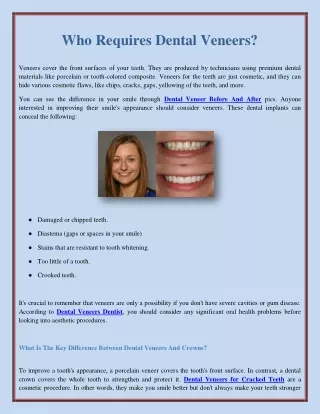 Who Requires Dental Veneers?