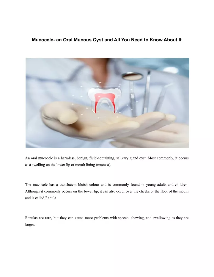 mucocele an oral mucous cyst and all you need