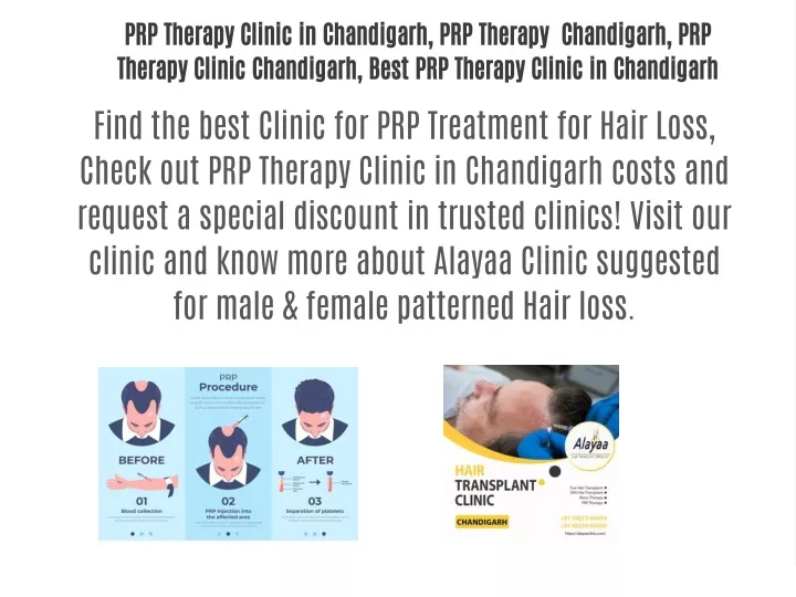 prp therapy clinic in chandigarh prp therapy