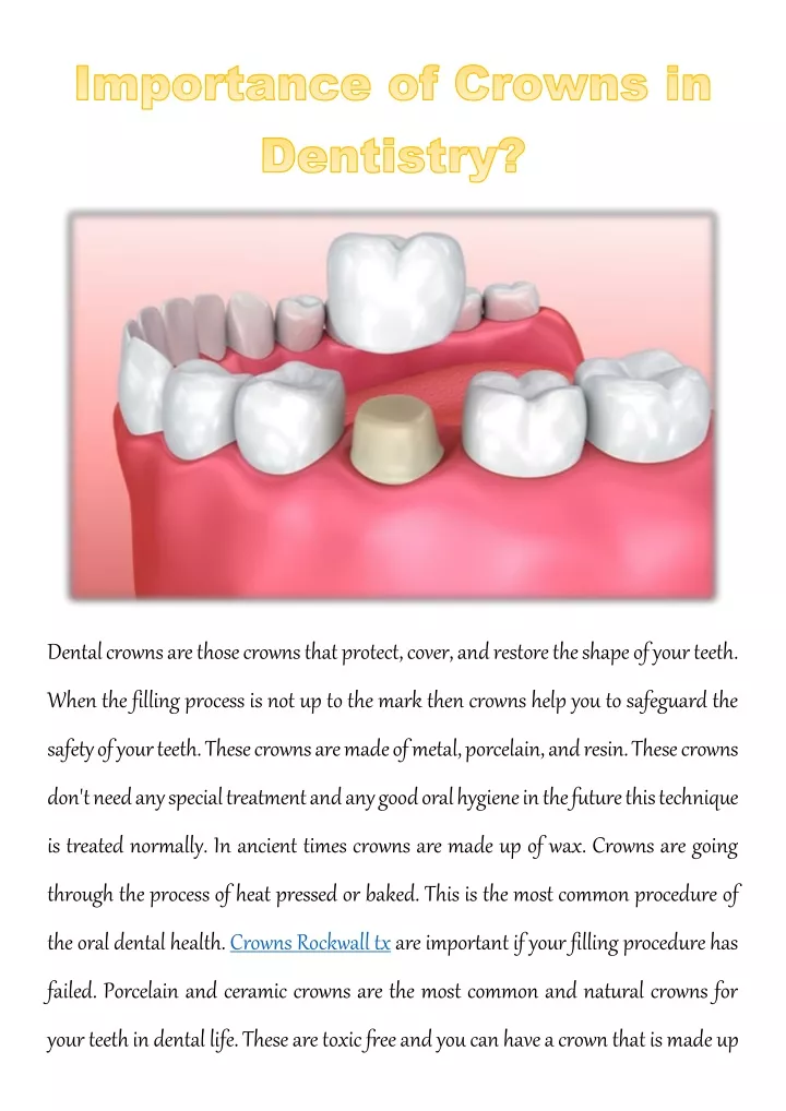 dental crowns are those crowns that protect cover