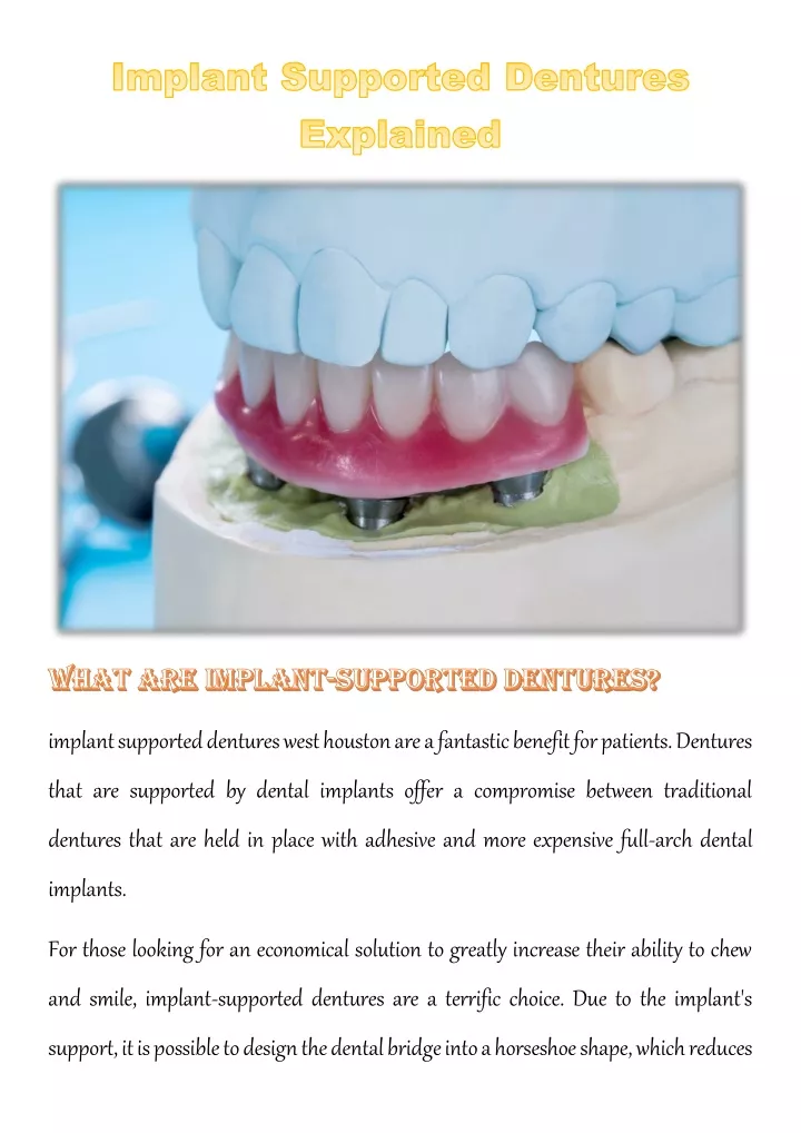 implant supported dentures west houston