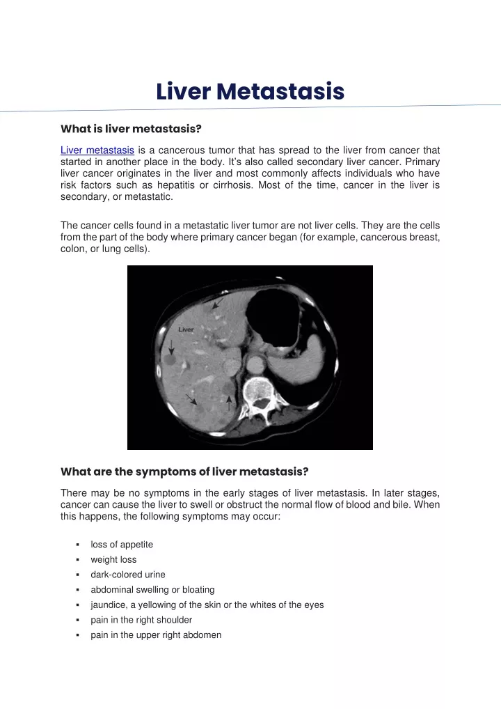 liver metastasis