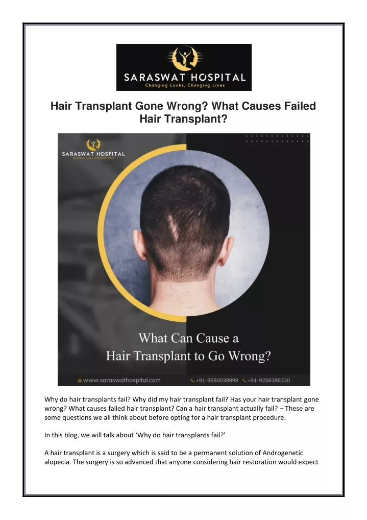 hair transplant gone wrong what causes failed