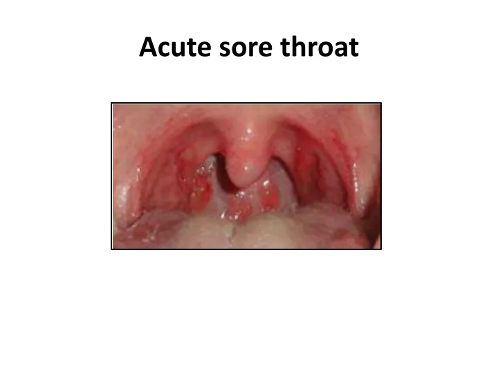 acute sore throat