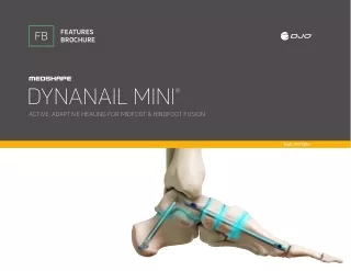 DYNANAIL MINI® ACTIVE, ADAPTIVE HEALING FOR MIDFOOT & HINDFOOT FUSION