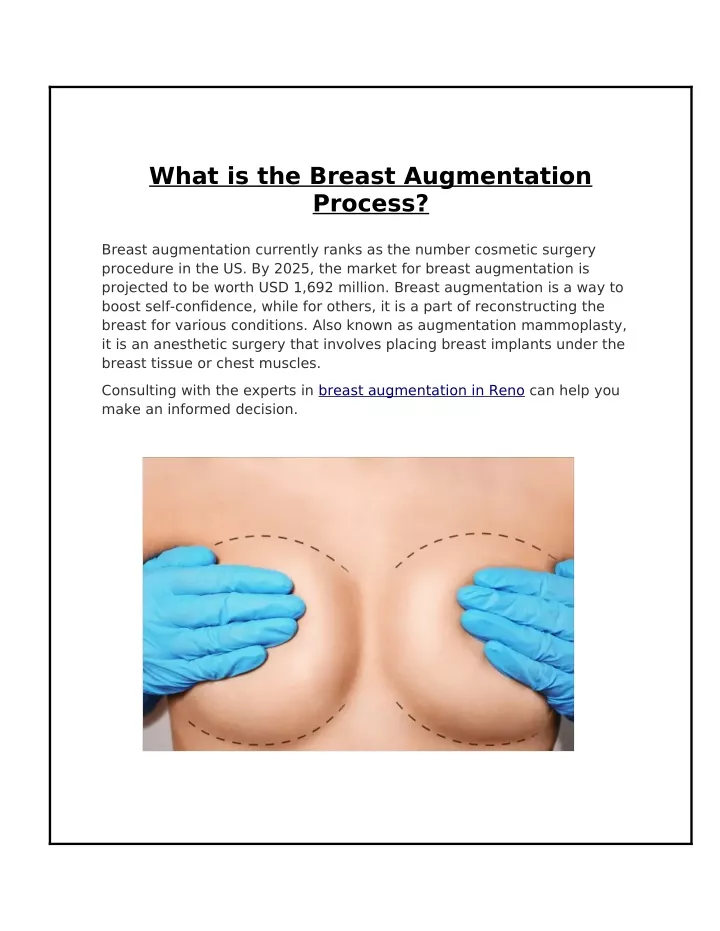 what is the breast augmentation process