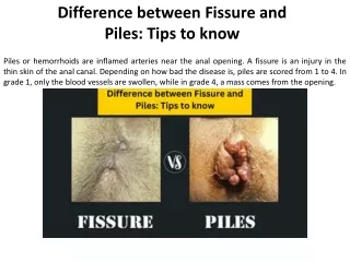 difference between fissure and piles tips to know
