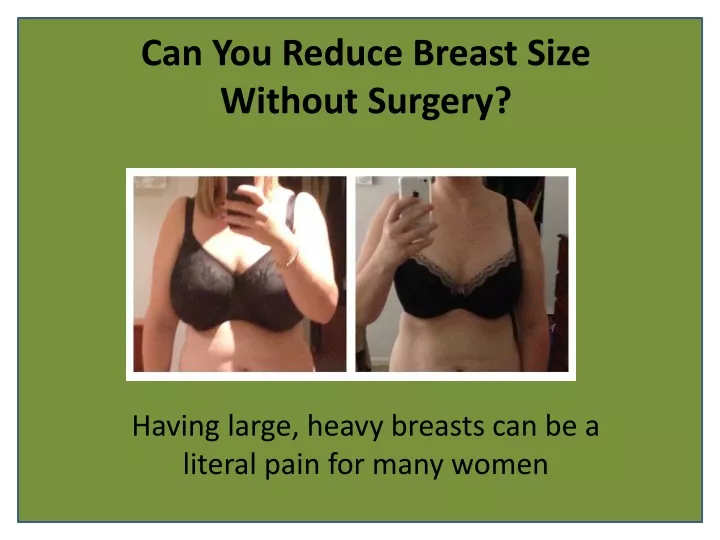 can you reduce breast size without surgery