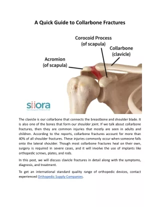 A Quick Guide to Collarbone Fractures.docx