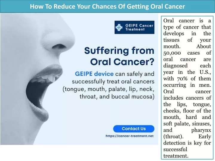 how to reduce your chances of getting oral cancer
