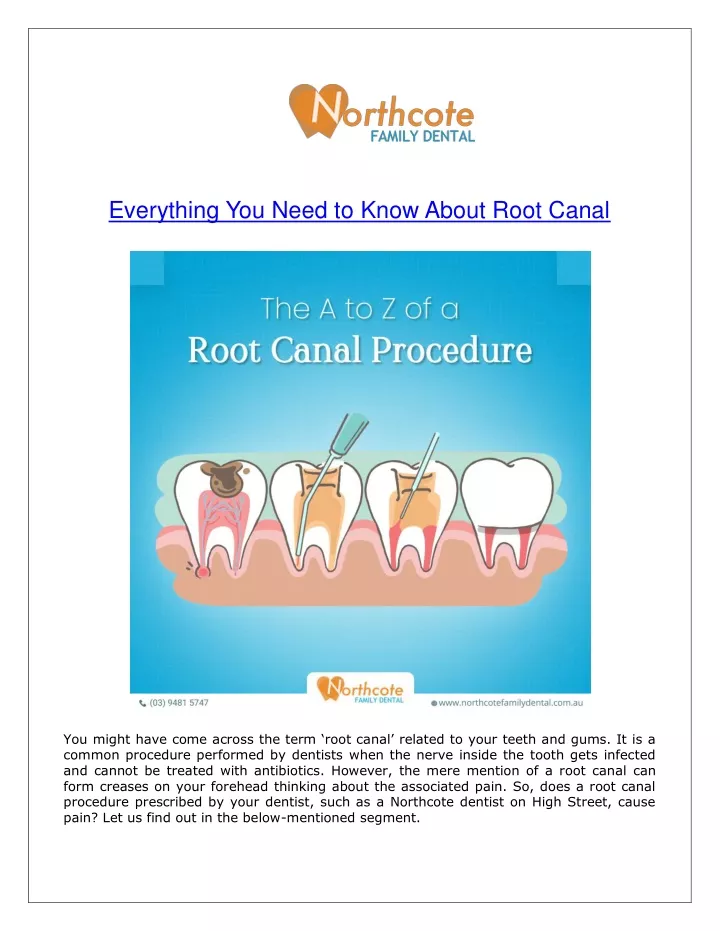 everything you need to know about root canal