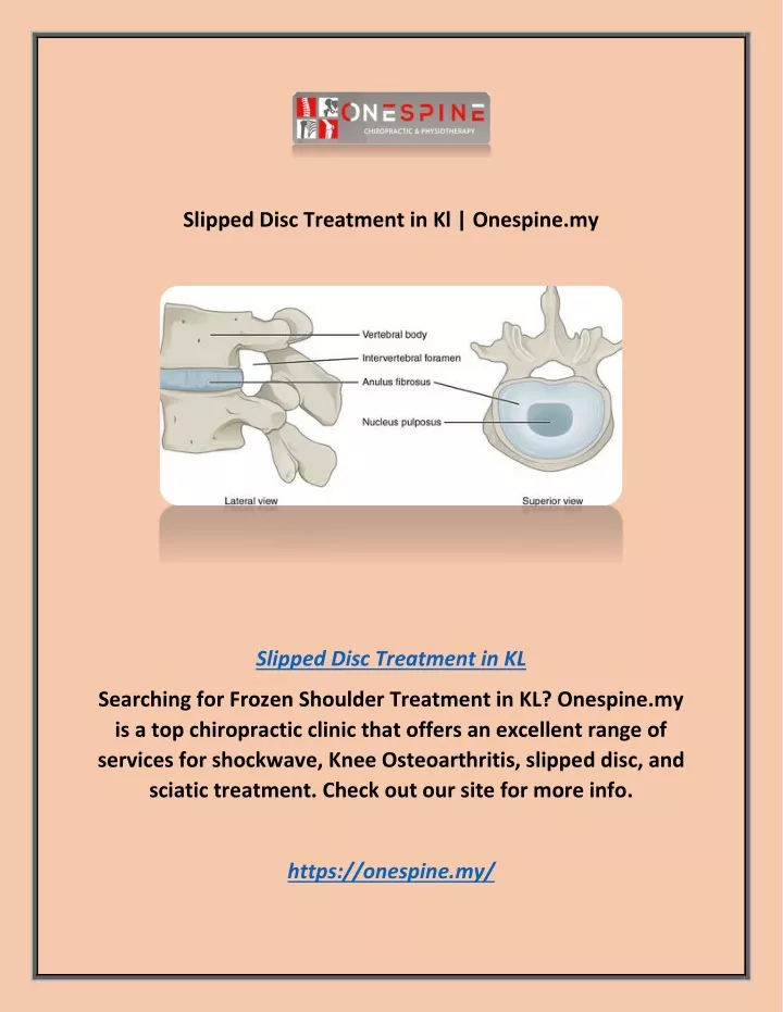 slipped disc treatment in kl onespine my