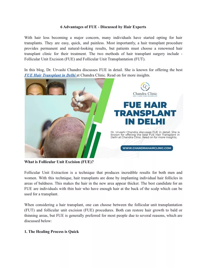 6 advantages of fue discussed by hair experts