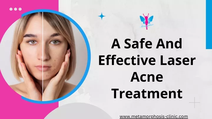 a safe and effective laser acne treatment