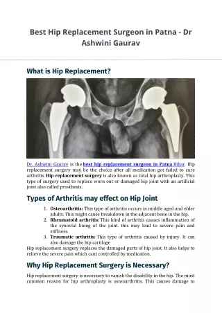 Best Hip Replacement Surgeon in Patna
