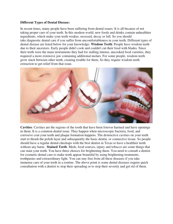 different types of dental disease