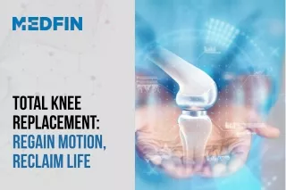 Total Knee Replacement - Regain Motion - Reclaim Life | Causes of Knee Pain
