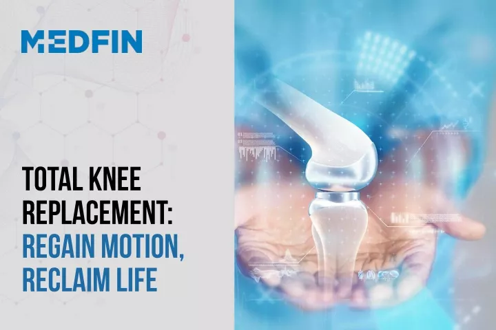 total knee replacement regain motion reclaim life