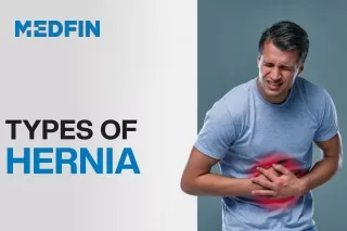 Types of Hernia - Everything you Need to Know | Hernia Surgery in India