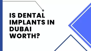 Tips to choose best Dental Implants.