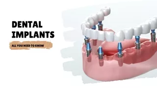 Dental Implants (2)