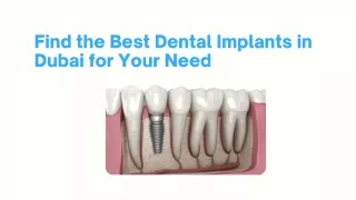 Find the Best Dental Implants in Dubai for Your Need