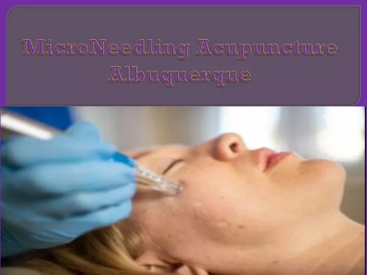 microneedling acupuncture albuquerque