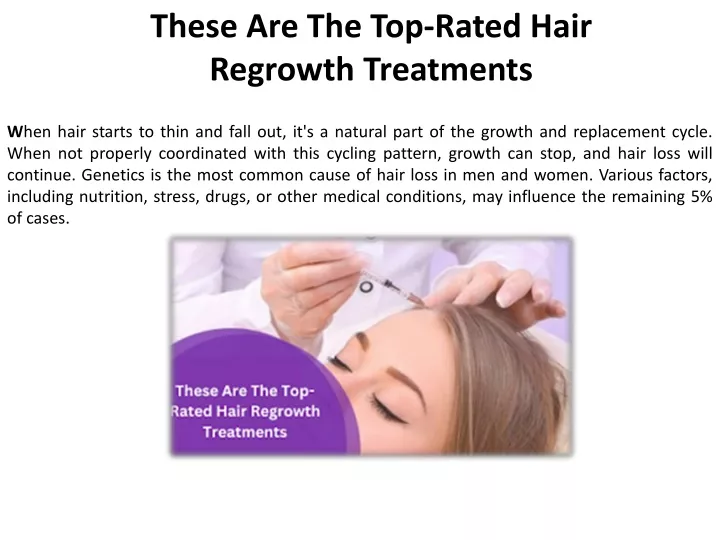 these are the top rated hair regrowth treatments