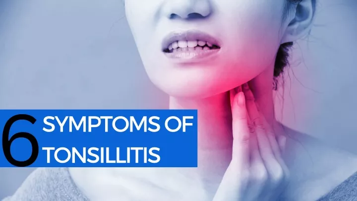 symptoms of tonsillitis 6