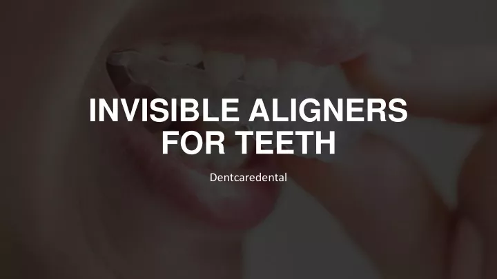 invisible aligners for teeth