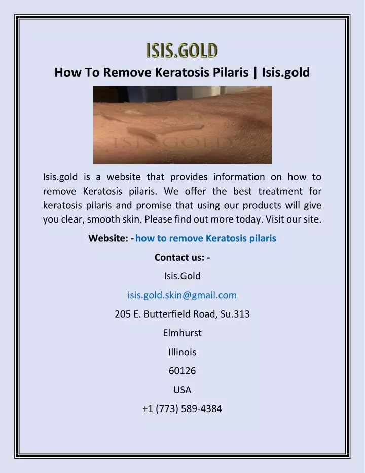 how to remove keratosis pilaris isis gold