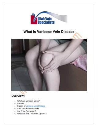 What Is Varicose Vein Disease