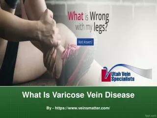 what is varicose vein disease