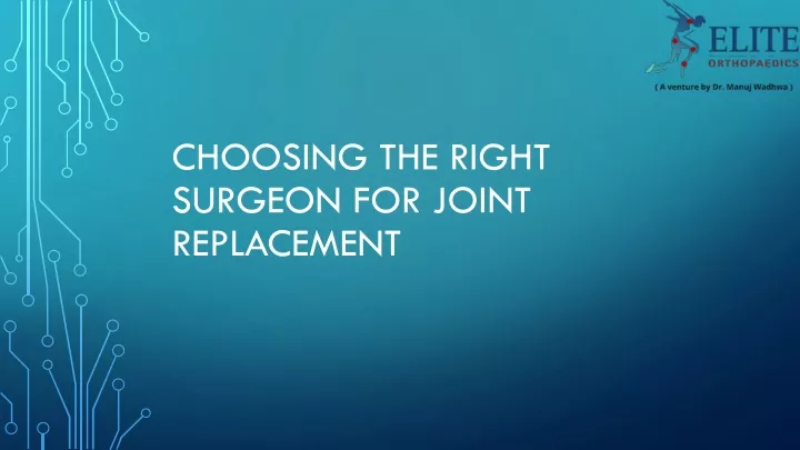 choosing the right surgeon for joint replacement
