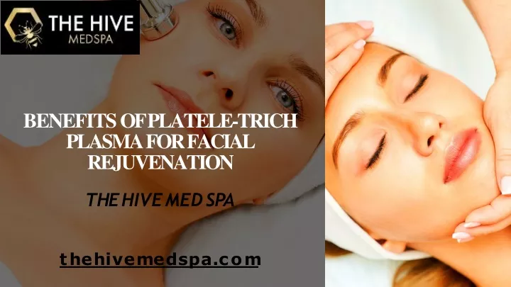 benefits of platele trich plasma for facial rejuvenation