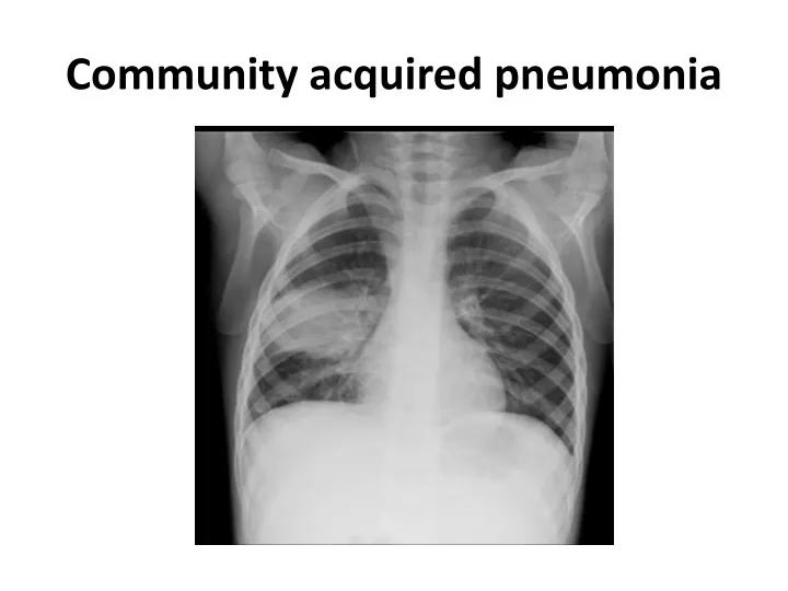 community acquired pneumonia