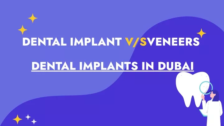 dental implant v sveneers