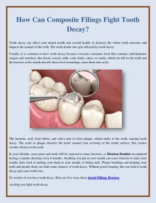 How Can Composite Filings Fight Tooth Decay?