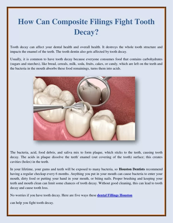 how can composite filings fight tooth decay