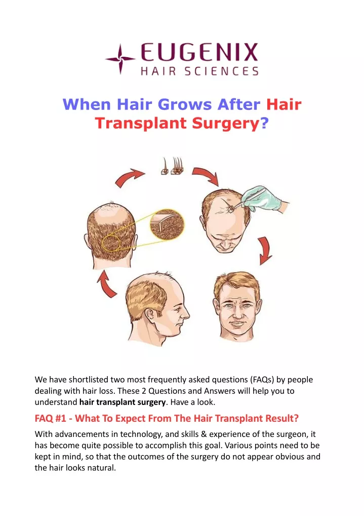 when hair grows after hair transplant surgery