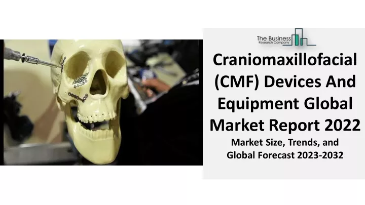 craniomaxillofacial cmf devices and equipment