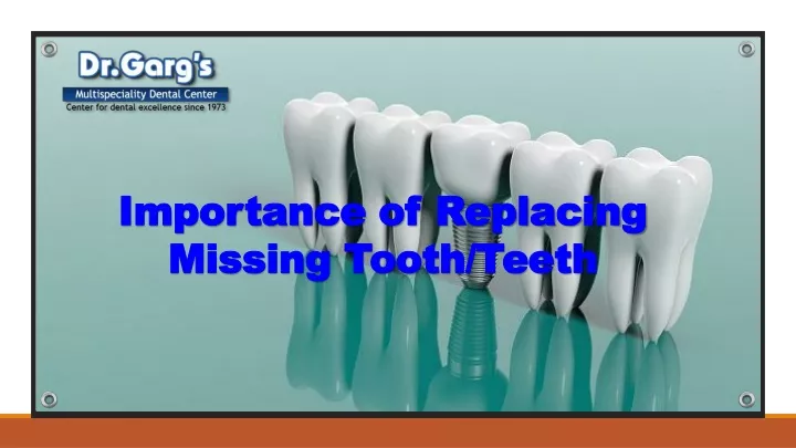 importance of replacing missing tooth teeth