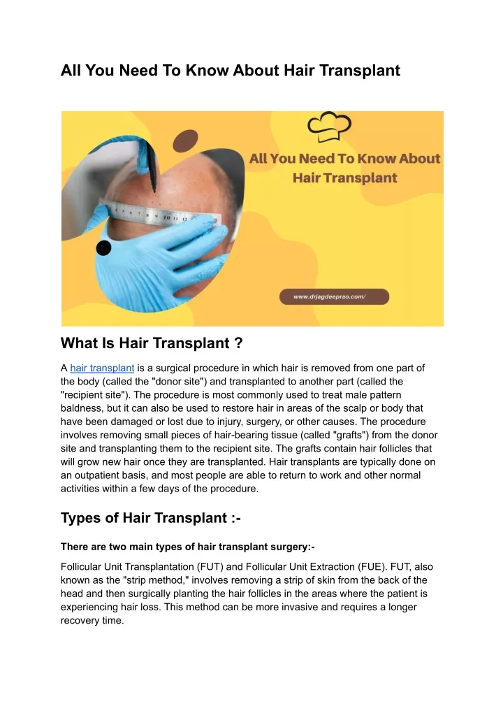 all you need to know about hair transplant