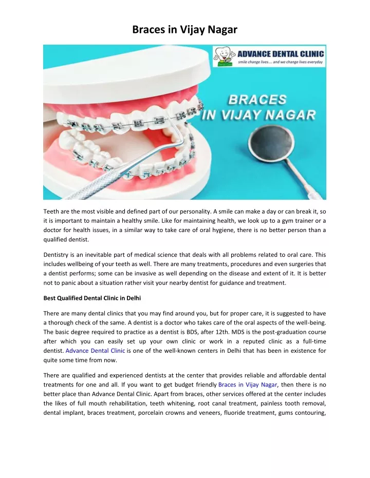 braces in vijay nagar