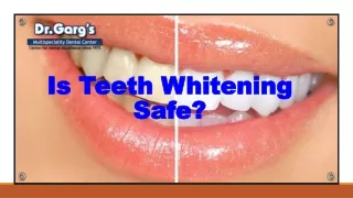 is teeth whitening safe