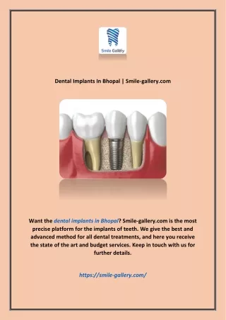dental implants in bhopal smile gallery com