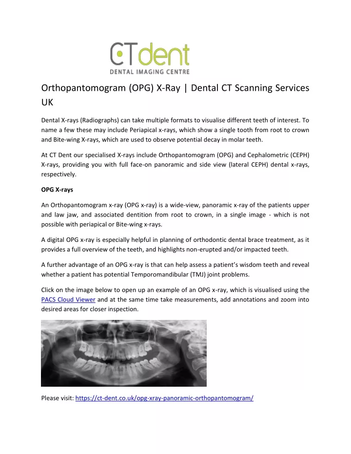 orthopantomogram opg x ray dental ct scanning