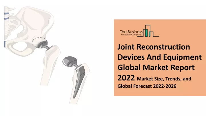 joint reconstruction devices and equipment global